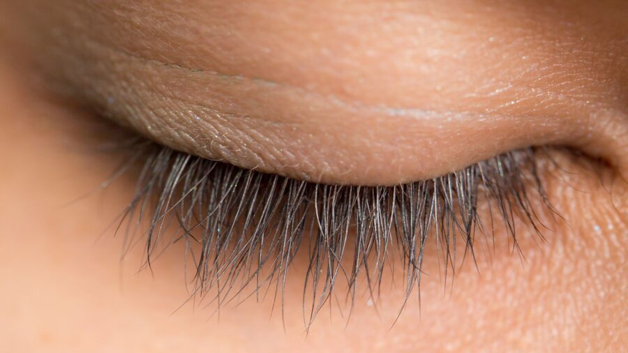 Waarom je niet moet slapen met lenzen in